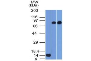 Western Blot of Recombinant, PC3 and HeLa cell lysates using p63 Mouse Monoclonal Antibody (TP63/1786). (p63 Antikörper  (AA 3-106))