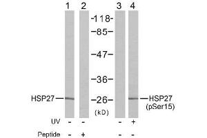 Image no. 2 for anti-Heat Shock 27kDa Protein 1 (HSPB1) (pSer15) antibody (ABIN196894) (HSP27 Antikörper  (pSer15))
