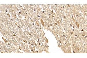 Detection of DCLK1 in Human Cerebrum Tissue using Monoclonal Antibody to Doublecortin Like Kinase 1 (DCLK1) (DCLK1 Antikörper  (AA 390-647))
