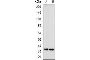 Western blot analysis of SGTA expression in A549 (A), U251 (B) whole cell lysates. (SGTA Antikörper)