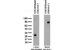 Transfected cell immunoblot: extracts of COS-1 cells transiently transfected with BKBeta4 or Kv2.