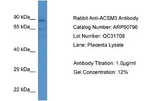 Western Blotting (WB) image for anti-Acyl-CoA Synthetase Medium-Chain Family Member 3 (ACSM3) (N-Term) antibody (ABIN786277) (ACSM3 Antikörper  (N-Term))