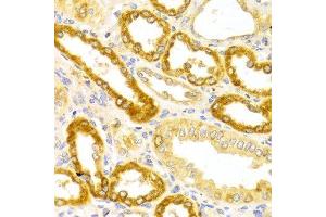 Immunohistochemistry of paraffin-embedded Human kidney using OLR1 antibody at dilution of 1:100 (x400 lens). (OLR1 Antikörper  (AA 58-273))