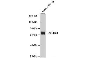 Western blot analysis of extracts of Mouse kidney using ZCCHC4 Polyclonal Antibody at dilution of 1:1000. (ZCCHC4 Antikörper)