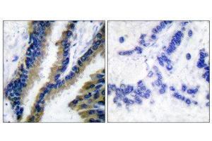 Immunohistochemistry (IHC) image for anti-Vav 1 Oncogene (VAV1) (Tyr174) antibody (ABIN1848167) (VAV1 Antikörper  (Tyr174))