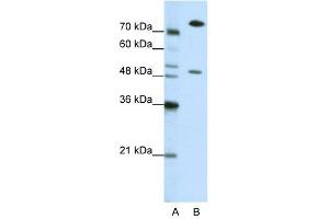 WB Suggested Anti-SSB Antibody Titration: 0. (SSB Antikörper  (N-Term))