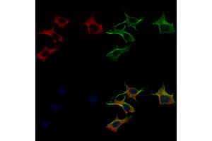 ABIN6258440 and ABIN6275234 staining 3 by IF/ICC.