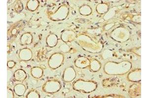 Immunohistochemistry of paraffin-embedded human kidney tissue using ABIN7145241 at dilution of 1:100 (BBS4 Antikörper  (AA 350-519))