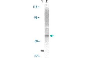 Western blot analysis using AKT2 monoclonal antibody, clone 1G8C12  against truncated AKT2 recombinant protein (Lane 1) and A-431 cell lysate (Lane 2). (AKT2 Antikörper)