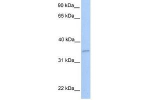 NKIRAS2 antibody used at 1 ug/ml to detect target protein. (NKIRAS2 Antikörper  (Middle Region))