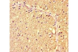 Immunohistochemistry of paraffin-embedded human brain tissue using ABIN7175986 at dilution of 1:100 (ZBTB46 Antikörper  (AA 174-362))
