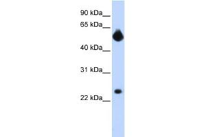 WB Suggested Anti-NOTCH4 Antibody Titration:  0. (NOTCH4 Antikörper  (Middle Region))