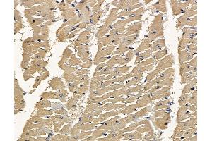ABIN7094925 and ABIN7098981 at 1/100 staining rat heart tissue by IHC-P. (Calpastatin Antikörper)