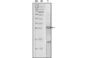 Western Blotting (WB) image for anti-Prostate Specific Antigen (PSA) (AA 26-251) antibody (ABIN2983296) (Prostate Specific Antigen Antikörper  (AA 26-251))
