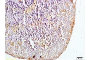 Immunohistochemistry (Paraffin-embedded Sections) (IHC (p)) image for anti-C-Type Lectin Domain Family 7, Member A (CLEC7A) (AA 41-140) antibody (ABIN740520)