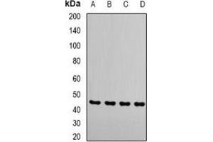 Western blot analysis of RRM2 expression in MCF7 (A), Hela (B), Jurakt (C), mouse thymus (D) whole cell lysates. (RRM2 Antikörper)