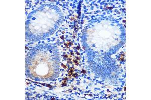 Immunohistochemistry of paraffin-embedded human appendix using CD41/ITGB Rabbit mAb (ABIN7267925) at dilution of 1:100 (40x lens). (Integrin Alpha2b Antikörper)
