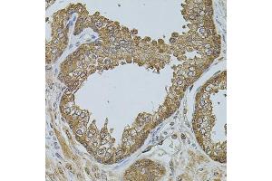 Immunohistochemistry of paraffin-embedded human prostate using CHRFA antibody (ABIN6131933, ABIN6138559, ABIN6138561 and ABIN6223818) at dilution of 1:100 (40x lens). (CHRFAM7A Antikörper  (AA 1-150))