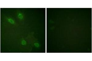 Immunofluorescence (IF) image for anti-Mediator Complex Subunit 1 (MED1) (AA 1423-1472) antibody (ABIN2888695) (MED1 Antikörper  (AA 1423-1472))
