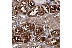 Immunohistochemical staining of human kidney with C20orf196 polyclonal antibody  shows strong cytoplasmic positivity in tubular cells at 1:50-1:200 dilution. (C20ORF196 Antikörper)