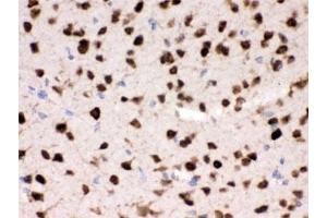 IHC testing of FFPE mouse brain with HuD antibody. (ELAV (Embryonic Lethal, Abnormal Vision, Drosophila)-Like (ELAVL) Antikörper)