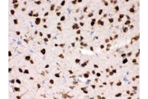 IHC testing of FFPE mouse brain with HuD antibody.