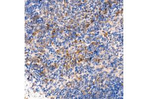 Immunohistochemistry (IHC) image for anti-Myeloid Differentiation Primary Response Gene (88) (MYD88) antibody (ABIN7268723)