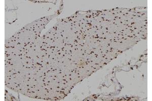 ABIN6276949 at 1/100 staining Human gastric tissue by IHC-P. (HOXA9 Antikörper  (Internal Region))