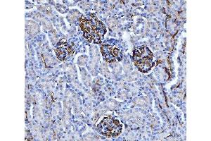 IHC analysis of CD147/Emmprin using anti-CD147/Emmprin antibody (ABIN7599999). (CD147 Antikörper  (AA 138-323))