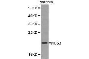 Western Blotting (WB) image for anti-Nitric Oxide Synthase 3 (Endothelial Cell) (NOS3) antibody (ABIN1873922) (ENOS Antikörper)