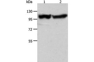 Western Blot analysis of Human fetal muscle tissue and hela cell using ACTN3 Polyclonal Antibody at dilution of 1:400 (ACTN3 Antikörper)