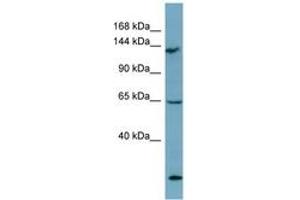 Image no. 1 for anti-LATS, Large Tumor Suppressor, Homolog 1 (Drosophila) (LATS1) (AA 971-1020) antibody (ABIN6741908) (LATS1 Antikörper  (AA 971-1020))
