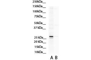 Western Blotting (WB) image for anti-Aspartate beta-Hydroxylase (ASPH) (N-Term) antibody (ABIN2784532)
