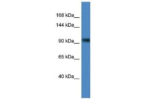 WB Suggested Anti-ZBTB4 Antibody Titration:  0. (ZBTB4 Antikörper  (C-Term))