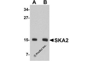 Western Blotting (WB) image for anti-Spindle and Kinetochore-Associated Protein 2 (FAM33A) (N-Term) antibody (ABIN1031572) (FAM33A Antikörper  (N-Term))