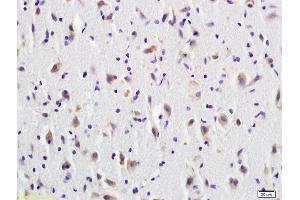 Formalin-fixed and paraffin embedded rat brain tissue labeled with Anti-CD137/TNFRSF9 Polyclonal Antibody, Unconjugated (ABIN740445) at 1:600 followed by conjugation to the secondary antibody (CD137 Antikörper  (AA 101-200))