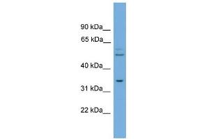 WB Suggested Anti-TOMM34 Antibody Titration: 0. (TOMM34 Antikörper  (N-Term))