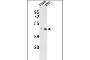 Western blot analysis of anti-MEK1 Antibody (/222) h in ,  cell line lysates (35 μg/lane).