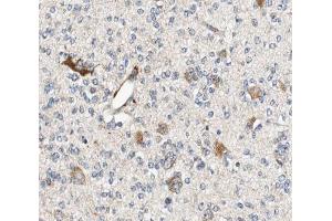 ABIN6266962 at 1/100 staining human brain tissue sections by IHC-P. (ALDOC Antikörper  (C-Term))