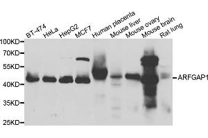 Western blot analysis of extracts of various cell lines, using ARFGAP1 antibody (ABIN5974280) at 1/1000 dilution. (ARFGAP1 Antikörper)