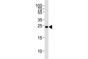 Western blot analysis of lysate from Ramos cell line using GRB2 antibody at 1:1000. (GRB2 Antikörper  (AA 187-216))