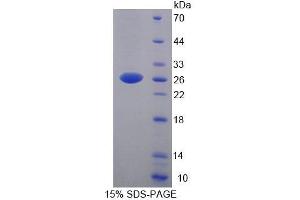 SDS-PAGE analysis of Human YAF2 Protein. (YAF2 Protein)