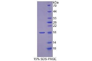 SDS-PAGE analysis of Rat MCEE Protein. (MCEE Protein)