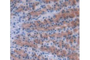 Used in DAB staining on fromalin fixed paraffin- embedded Kidney tissue (Ninein Antikörper  (AA 1-153))