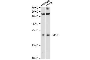 Western blot analysis of extracts of various cell lines, using MAX antibody. (MAX Antikörper)