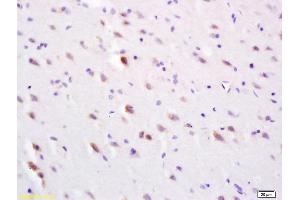 Immunohistochemistry (IHC) image for anti-Solute Carrier Family 30 (Zinc Transporter), Member 3 (Slc30a3) (AA 20-75) antibody (ABIN1386246)
