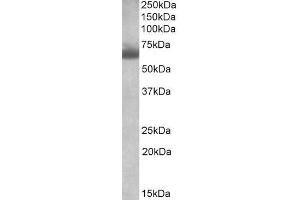 ABIN571287 (1µg/ml) staining of Human Testis lysate (35µg protein in RIPA buffer). (BBS4 Antikörper  (AA 33-46))