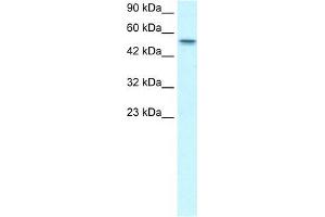 Western Blotting (WB) image for anti-Runt-Related Transcription Factor 1, Translocated To, 1 (Cyclin D-Related) (RUNX1T1) (Middle Region) antibody (ABIN1108915)
