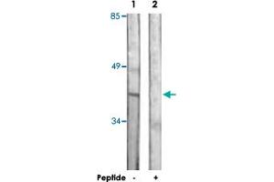Western blot analysis of extracts from Jurkat cells, using DUSP1 polyclonal antibody .