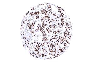 Strong CD34 immunostaining of blood vesels in a mature placenta (Rekombinanter CD34 Antikörper)